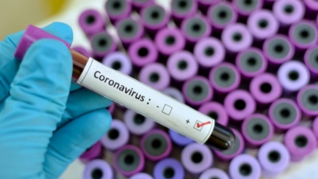 KORONAVIRUSI/ Turqia do të përdorë kitin diagnostikues që nxjerr rezultatin për COVID-19 për 15 minuta