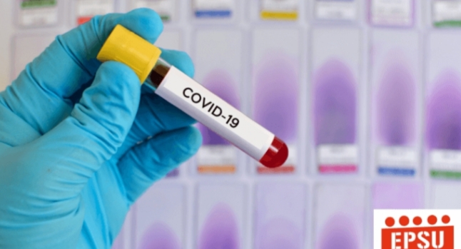KORONAVIRUSI/ Del platforma zyrtare: Të dhënat e fundit nga Shqipëria për epideminë
