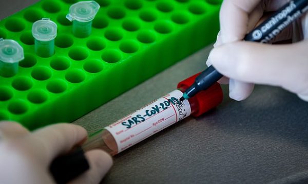 KORONAVIRUSI/ Shkencëtarët britanikë: COVID-19 nuk është armë biologjike e krijuar në laborator