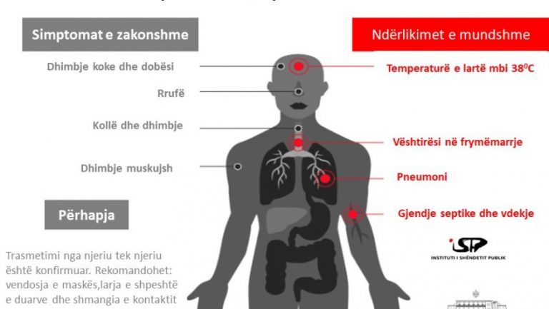 KORONAVIRUSI NË SHQIPËRI/ ISHP: Masat kryesore, si mund ta parandaloni prekjen nga ky virus