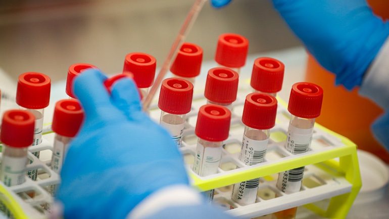 KORONAVIRUSI/ Austria zbaton këshillat e OBSH-së, 15 mijë teste në ditë për COVID-19