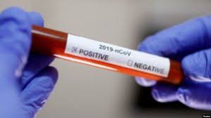 KORONAVIRUS/ Një milion paisje testimi për laboratorët amerikanë