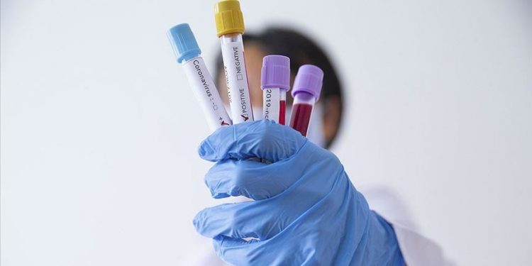 KORONAVIRUSI/ Flet epidemiologu: Shqipëria i ka kapacitetet për të përballuar situatën