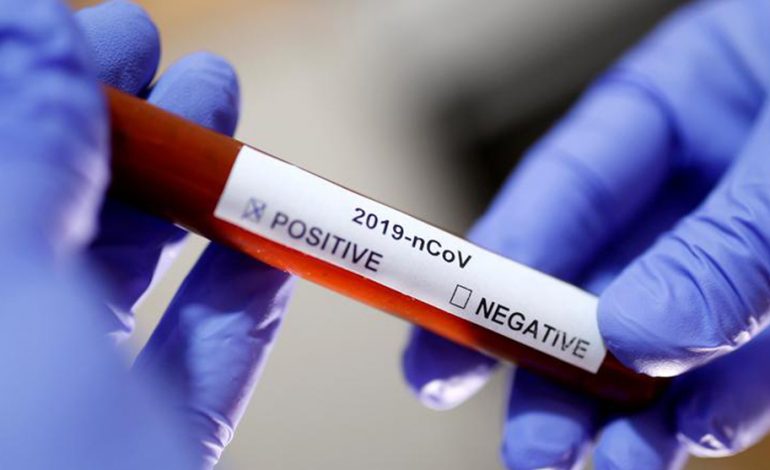 LAJM I MIRË/ Del negativ në testin e parë, drejt shërimit 62-vjeçari i infektuar me koronavirus në Elbasan