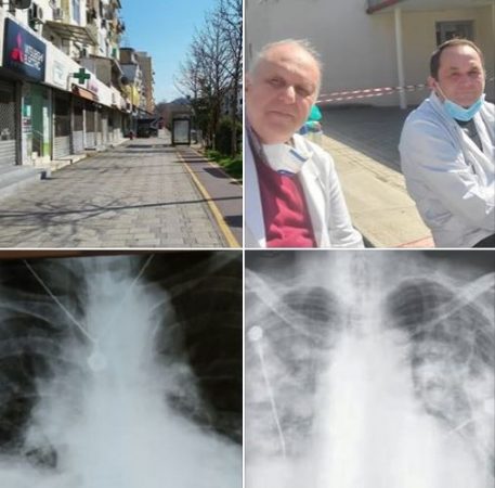 “PËR HIR TË JETËS”/ Mjeku Tritan Kalo tjetër mesazh shqiptarëve: Ju duam, por duajeni edhe ju veten. Izolohuni!