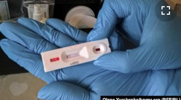 COVID-19/ Serbia i dhuron Kosovës teste për koronavirus