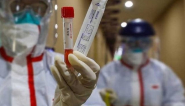 STUDIM I PABESUESHËM NË ITAL/ Koronavirus fshihet në lotët e të sëmurëve edhe pasi pacienti është testuar negativ