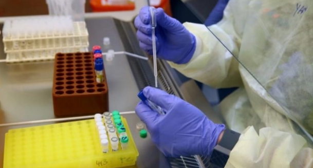 COVID-19/ Mikrobiologu rus i hedh benzinë zjarrit: Kinezët bënë gjëra të çmendura në laboratorin e Wuhanit