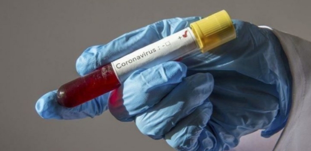 COVID-19/ Pandemia duhet të jetë një zile alarmi