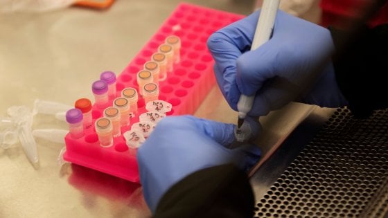 KORONAVIRUSI/ Studimi amerikan: Numri i të infektuarve në botë është 50 deri 85 herë më i lartë se shifrat zyrtare