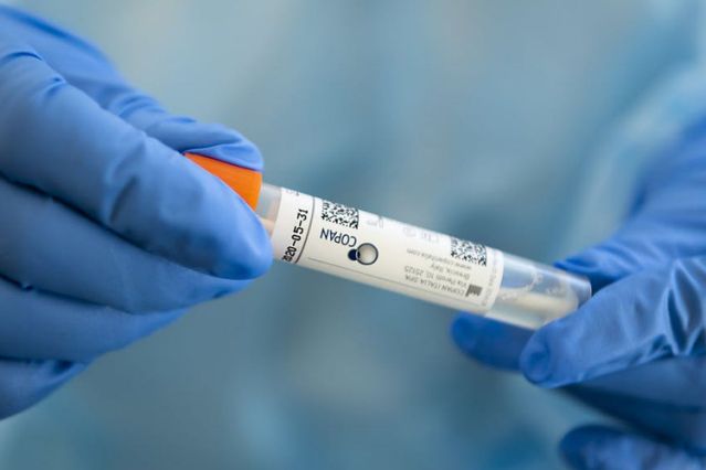 KORONAVIRUSI/ Rast unik, 23-vjeçarja ende pozitive për Covid-19 pas 55 ditësh