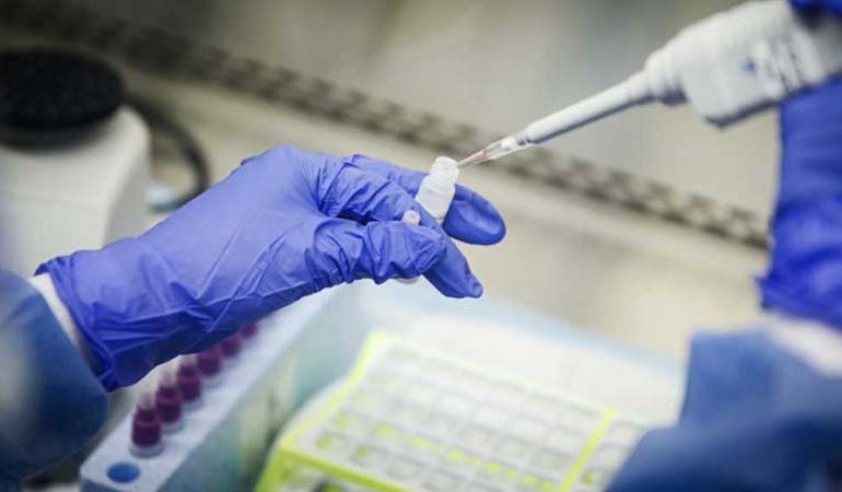KORONAVIRUSI/ FDA miraton testimet në shtëpi