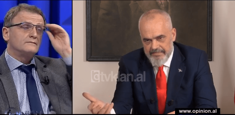 “S’MË NJEH NËNA PO TË BËJ BOTOKS”/ Rama BATUTA për pamjen me mjekun