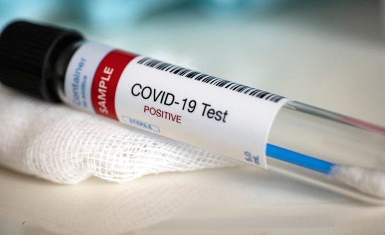 KORONAVIRUSI/ Testi serologjik i COVID-19 është premtues, por nuk është certifikuar ende