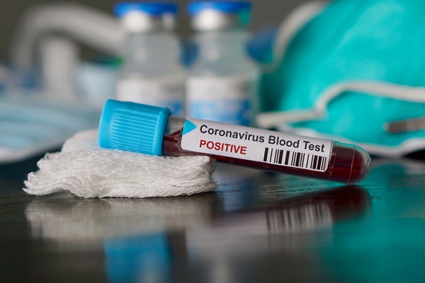 DALIN FAKTET E REJA/ OBSH: Nëse prekesh nga koronavirusi…