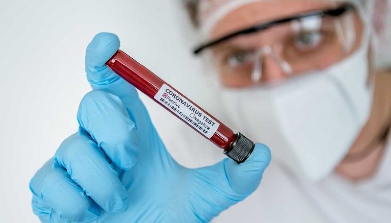 “UNË PRES QË COVID TË ELEMINOHET…”/ Epidemiologu: Nëse nuk shfaqen raste të reja për 14 ditë virusi…