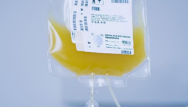 KORONAVIRUSI/ Studimi italian: Kura me plazmën hiperimune ulë vdekshmërinë nga 15% në 6%