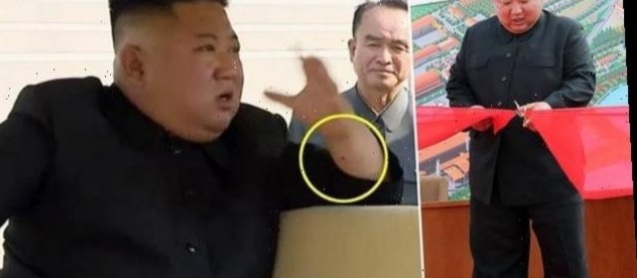 A KA BËR KIM JONG-UN OPERACION NË ZEMËR? Ekspertët mjekësorë tregojnë shenjat në duart e diktatorit dhe flasin për… (FOTOT)