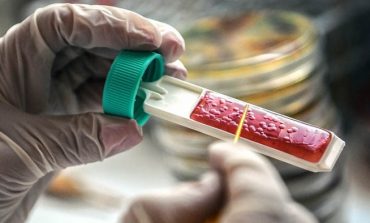 ZBULIMI I RI SHKENCOR/ Ja pse koronavirusi është më vdekjeprurës në Europë se sa në Kinë