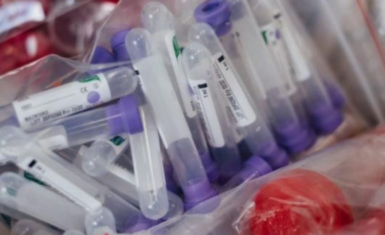COVID-19/ Zbuloni risinë më të fundit të testeve të anti-trupave ndaj koronavirusit