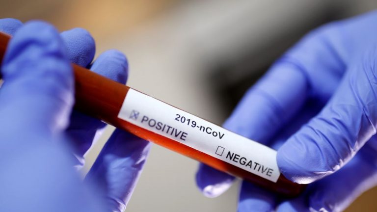 COVID-19/ Rreth 800 mijë të infektuar me koronavirus në Amerikën Latine, gjysma në Brazil