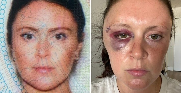 E DHUNUAR BRUTALISHT/ Gruaja akuzon personazhin e njohur (FOTOT)