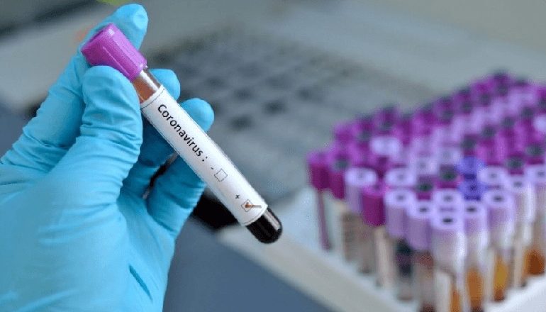 KORONAVIRUSI/ Dy raste të reja me covid-19, një në Vlorë dhe një në Elbasan