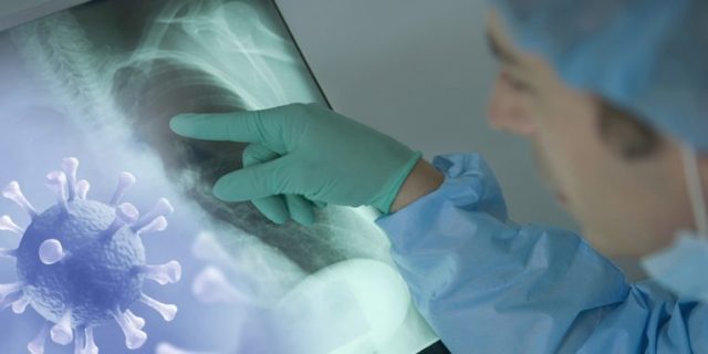KORONAVIRUSI/ Shkencëtarët flasin për efektet afatgjata të të shëruarve me Covid-19: Menduam se ishte virus i frymëmarrjes