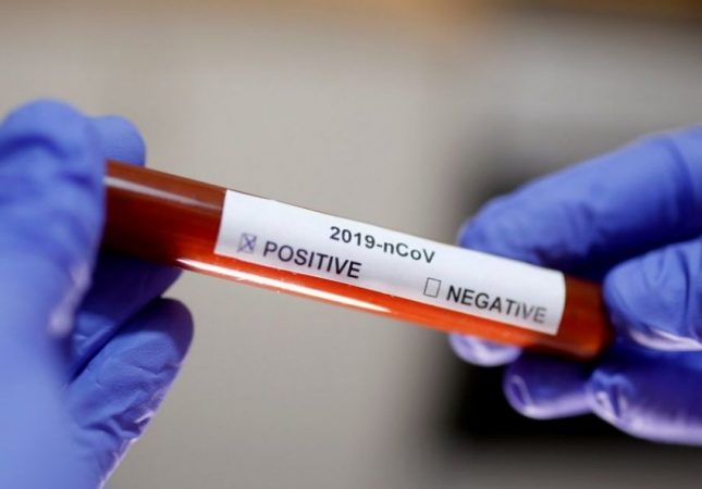 “E GJUNJËZUAR” NGA COVID-19/ Regjistrohen 2 viktima dhe 125 raste të reja me koronavirus në Maqedoninë e Veriut