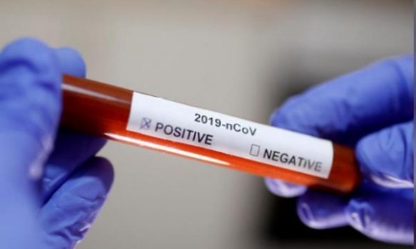 KOSOVË/ Ministri i Shëndetësisë: Do të kalojmë në testime masive, mund të kemi valë të dytë me coronavirus
