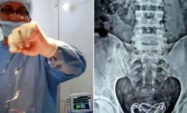 E PABESUESHME/ 30-vjeçari gëlltiti karikuesin e telefonit, mjekët ia heqin nga trupi (FOTOT)
