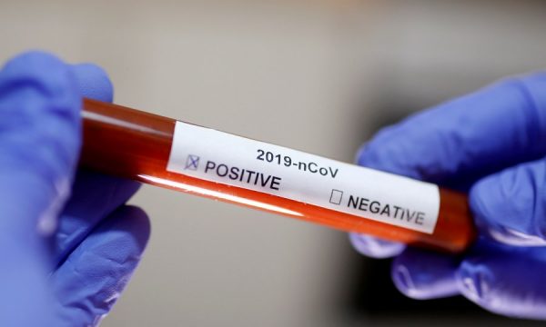 COVID-19/ Eksperti: Vetëm 10 % e njerëzve të infektuar me koronavirus zhvillojnë antitrupa