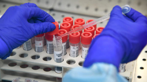 RRITET NUMRI I INFEKTIMEVE ME COVID NË KRUJË/ Ekspertët e shëndetit kryejnë 80 testime