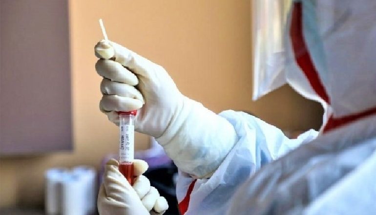 COVID-19/ I burgosuri në Berat infektoi me koronavirus 4 të afërm