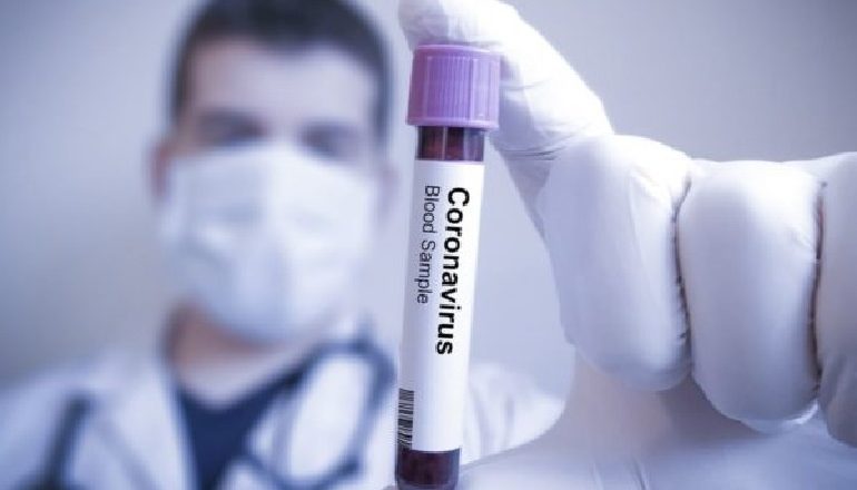 COVID-19/ Medikamenti i ri rus, vret 77,5% të virusit në 5 ditët e para