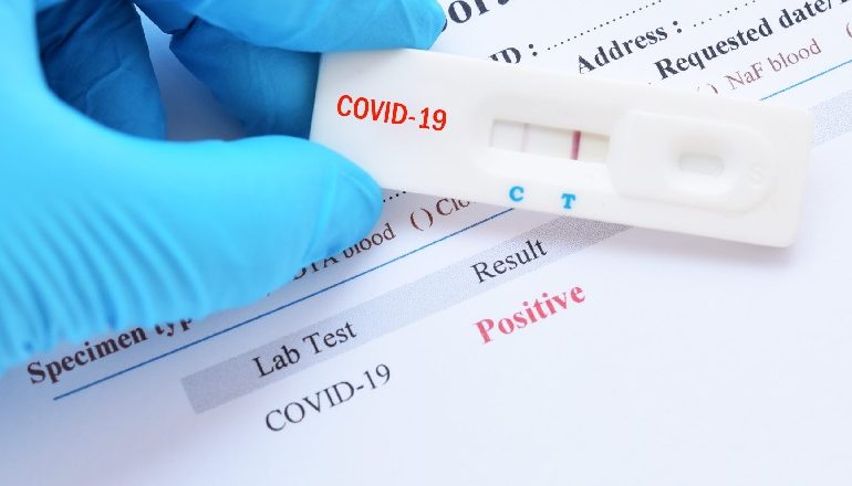COVID-19/ Përfundimi shqetësues i studimit britanik: Imuniteti nuk duket se zgjat shumë
