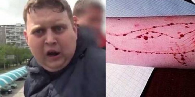 E RËNDË/ Rikthehet loja e frikshme e “Balenës blu”, policia paralajmëron qytetarët