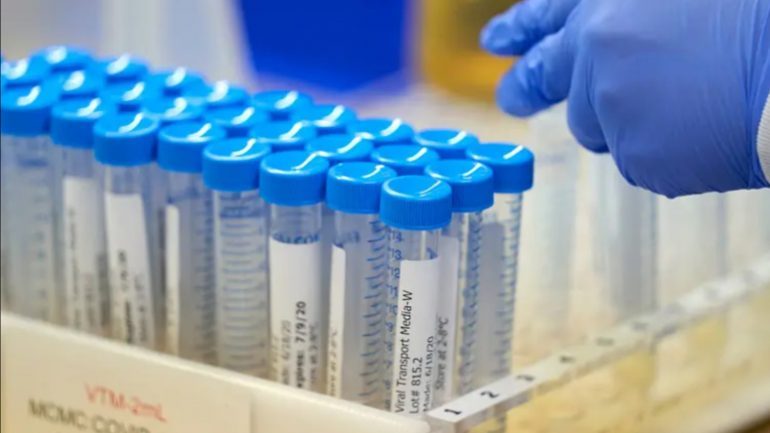 COVID-19 NË KOSOVË/ Infektohen me koronavirus 14 mjekë në Pejë, angazhohen vullnetarët