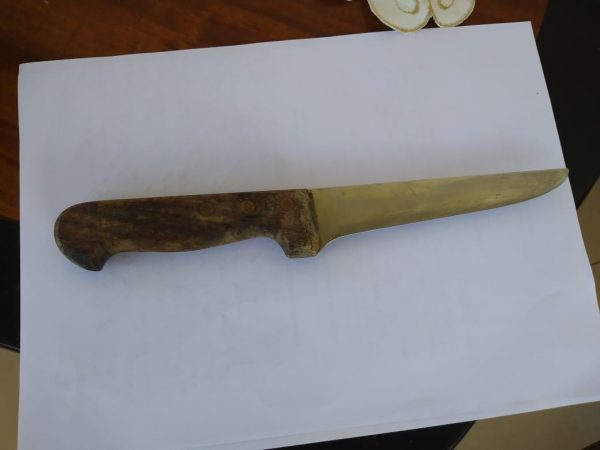TRAGJIKE/ U qëllua me thikë, vdes 46-vjeçari nga Patosi