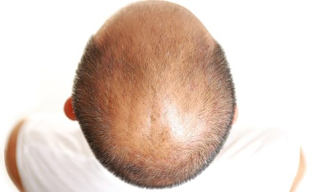 RREZIKU NGA COVID-19/ Studimi: Burrat që kanë humbur flokët janë 40% më të predispozuar të përfundojnë në…
