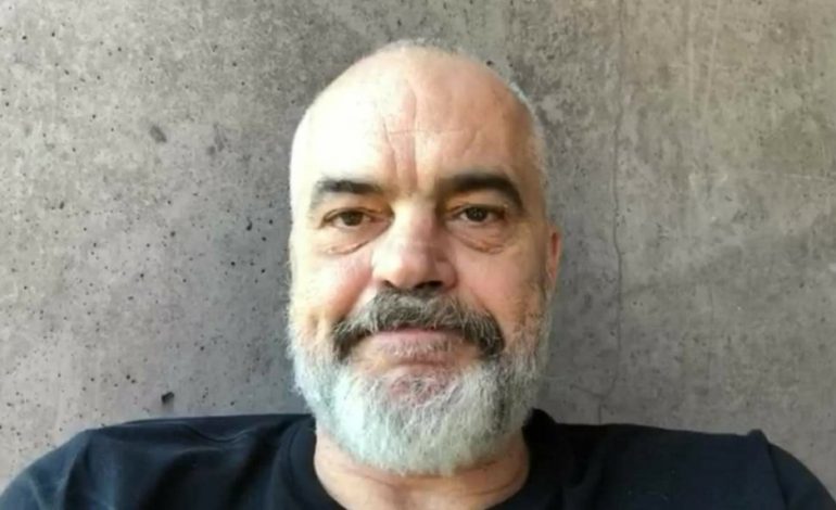 “S’TË VJEN E KEQJA NGA BYPASS-i”/ Rama “korrigjon” qytetarin: Meqë e ke kaq merak gjuhën, jo “ja merr” po… (BATUTAT)
