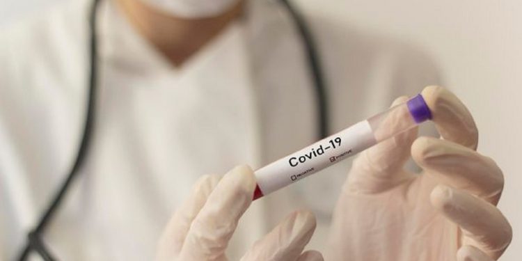 FLASIN MJEKËT/Zbulohen simptoma të reja të Covid-19