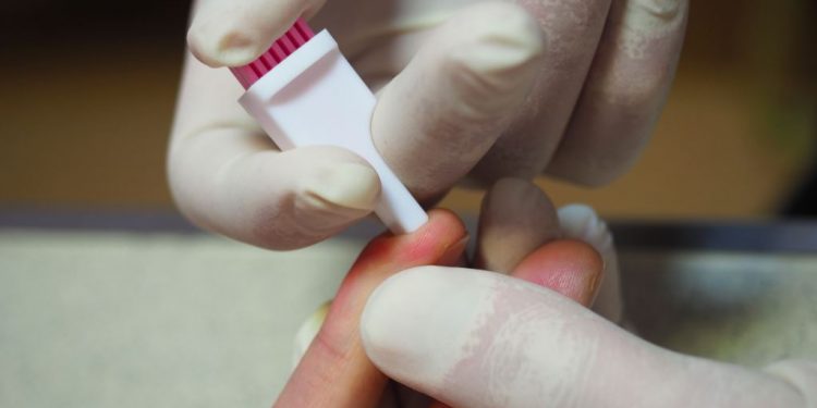ALARMI/ OKB: Koronavirusi rrezikon betejën kundër HIV-it