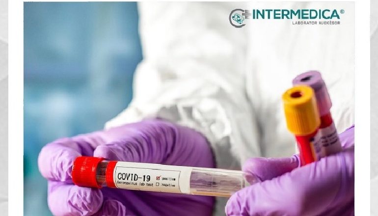 KORONAVIRUSI/ Testimi për antitrupat sars cov-2 totale (IgG + IgM) nga Intermedica. I vetmi me dy metoda, me dy kompani