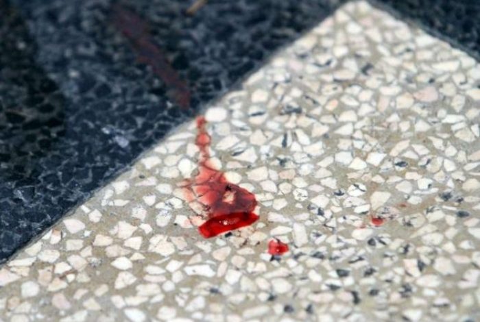 NGJARJE E RËNDË NË KAVAJË/ 19-vjeçari i ngul thikën gjyshit të tij, i moshuari… (DETAJET)