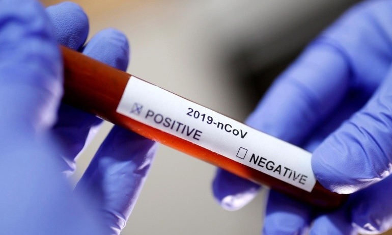COVID-19 PREK INSTITUCIONET NË LUSHNJE/ Pezullohet puna, një punonjëse ka rezultuar pozitive