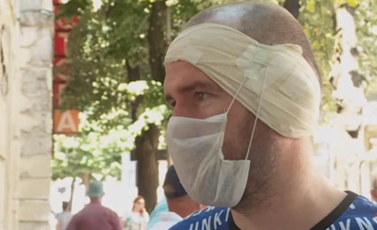 “S’KAM MUNDUR AS TË LEXOJ”/ I riu shqiptar denoncon dhunën: Polici serb më rrahu derisa më ra të fikët