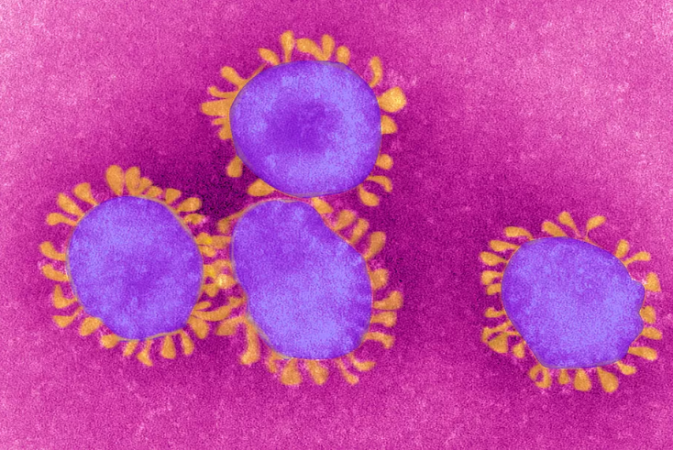COVID-19/ Nga ajri tek prodhimi i kopjeve të ARN-së, si e “merr peng trupin”, koronavirusi