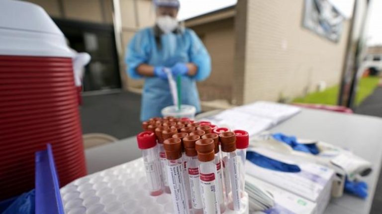 KOSOVË/ Shtohen laboratorë të licencuar për testimin ndaj COVID-19, 98 në gjithë vendin