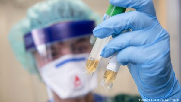 COVID-19/ Studimi zbulon si infektohen me koronavirus shumica e gjermanëve, ja vendet më të rrezikuara, mes tyre dhe shkollat